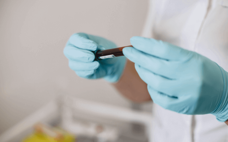 Blood Test Thumbnail